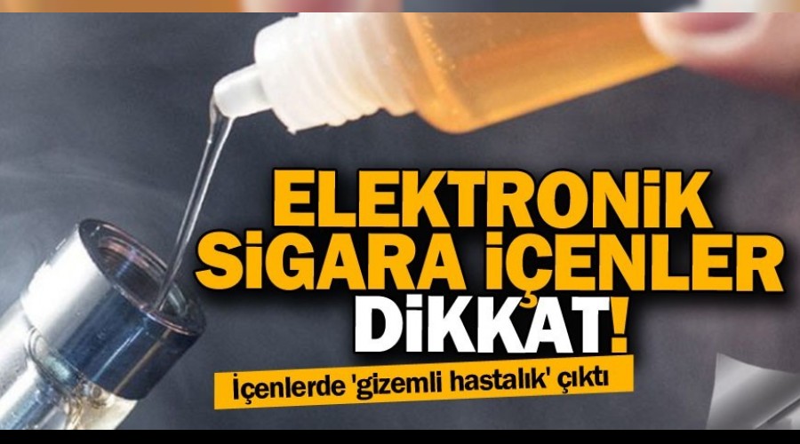 Elektronik sigaradan 'gizemli hastalk' kt